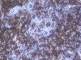 Monoclonal Mouse anti-Human CD2 Antibody (clone OTI1C5, IHC, WB)