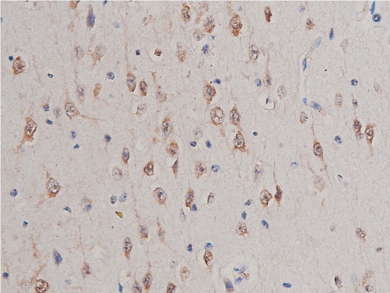Polyclonal Rabbit anti-Human GSK3A / GSK3 Alpha Antibody (IHC, WB)