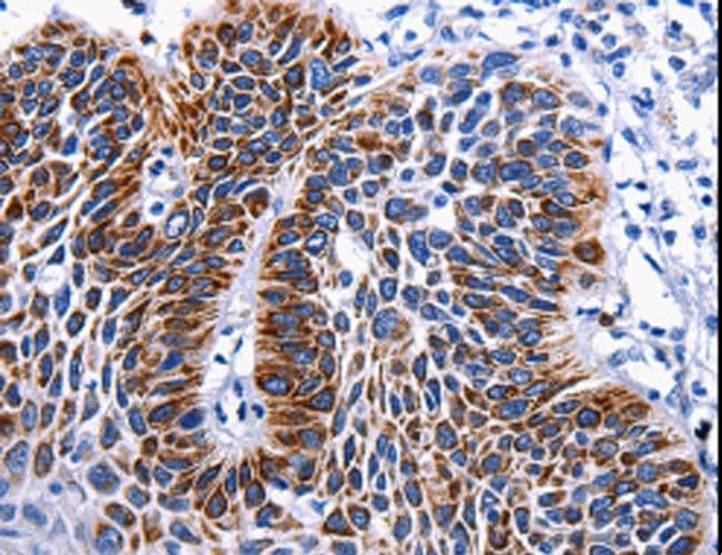 RAB25 Antibody