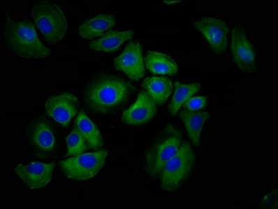Polyclonal Rabbit anti-Human HAS1 / HAS Antibody (IF)