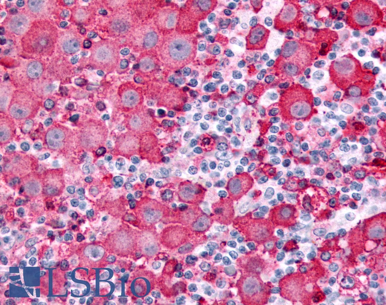 PathPlus™ SGK2 Antibody (Kinase Domain)