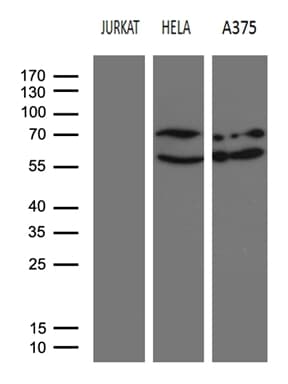 Monoclonal Mouse anti-Human NFKBIE / IKB Epsilon Antibody (clone OTI1E5, Carrier-free, WB)
