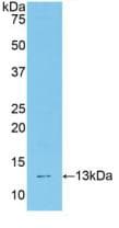 TCF20 Antibody (aa1871-1965)