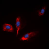 Polyclonal Rabbit anti-Human IGFBP1 Antibody (Internal, IF, WB)