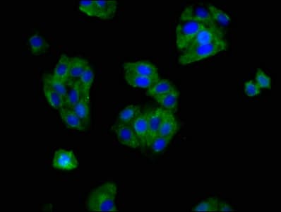 OPRM1 / Mu Opioid Receptor Antibody