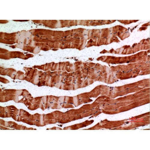 IHC-plus™ ALDH2 Antibody (41-90 aa, N-terminal)