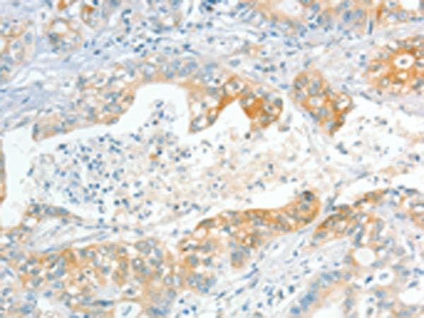 APOL2 / Apolipoprotein L 2 Antibody