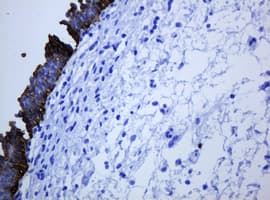 KRT5 / CK5 / Cytokeratin 5 Antibody (clone OTI4A7)