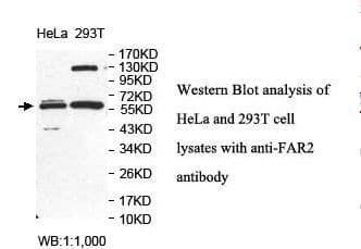 Polyclonal Rabbit anti-Human FAR2 Antibody (aa111-267, IHC, WB)