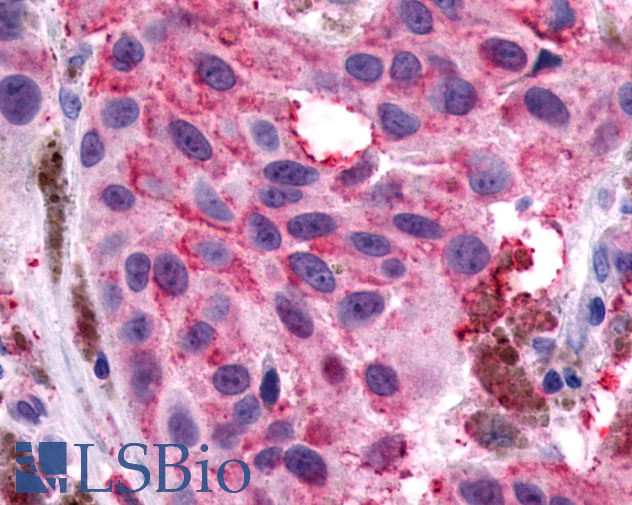 IHC-plus™ Polyclonal Rabbit anti-Human NPY1R Antibody (Extracellular Domain, IHC)