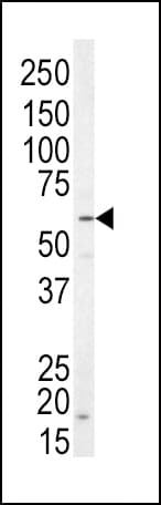 IHC-plus™ NRG1 / Heregulin / Neuregulin Antibody (aa198-229)