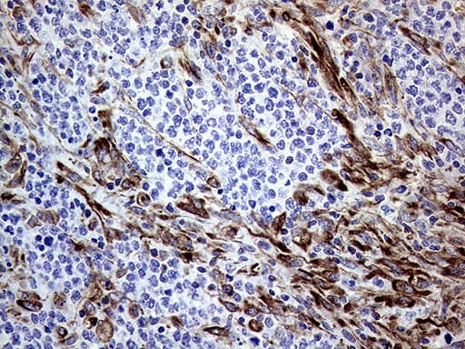 MLPH / Melanophilin Antibody (aa295-600, clone OTI6E3)