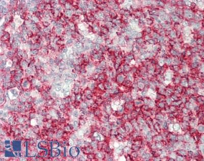 IHC-plus™ Monoclonal Mouse anti-Human TET3 Antibody (clone 11E11, aa241-568, IHC, WB)