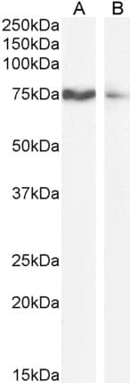 SLCO1B3 / OATP8 Antibody (aa151-161)