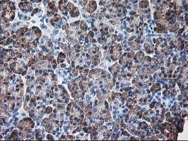 RPN1 / Ribophorin I Antibody (clone OTI3H3)