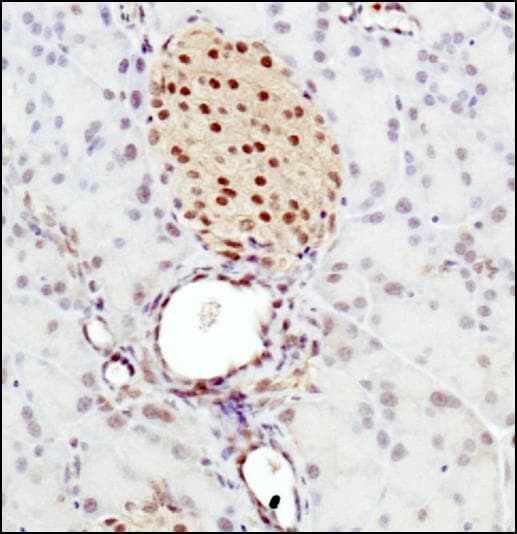 Polyclonal Rabbit anti-Human BHLHE41 / BHLHB3 / SHARP1 Antibody (aa1-75, IHC, WB)