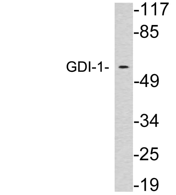 GDI1 Antibody (aa394-443)