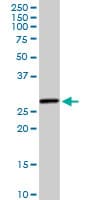 Monoclonal Mouse anti-Human HSD17B8 / RING2 Antibody (clone 4F1, WB)