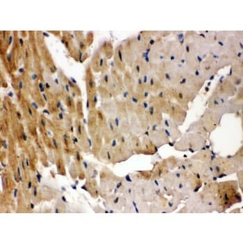 GRK5 Antibody (aa393-429)