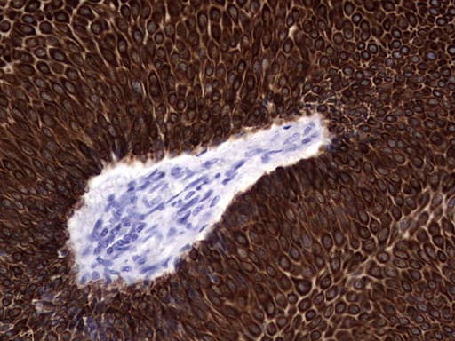 Monoclonal Mouse anti-Human KRT19 / CK19 / Cytokeratin 19 Antibody (clone OTI1E7, aa240-390, IHC)