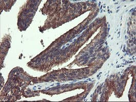 RPN1 / Ribophorin I Antibody (clone OTI5B1, Carrier-free)