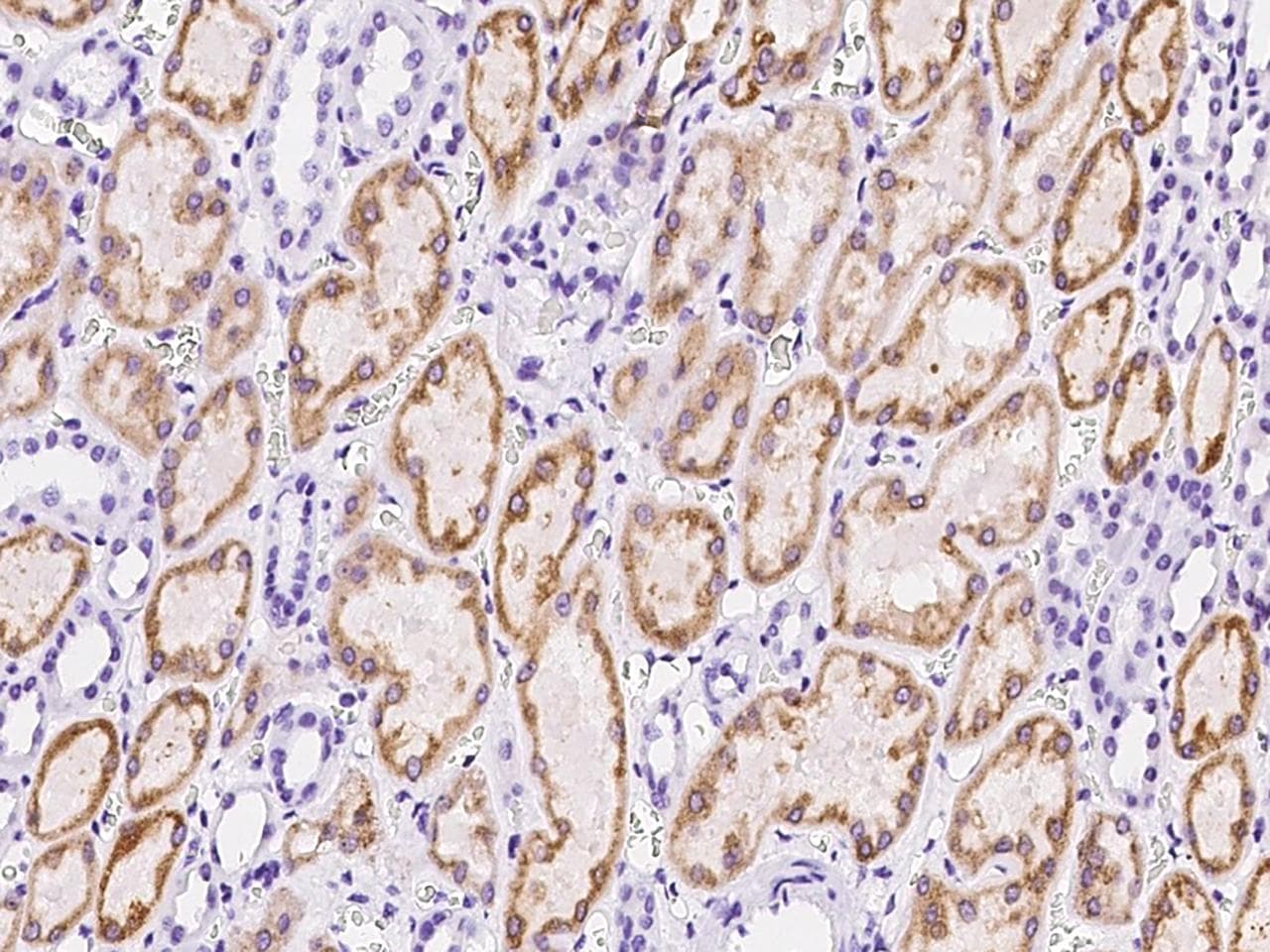 LRPAP1 Antibody (Preservative Free)