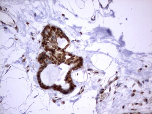 HMBS / PBGD Antibody (clone UMAB144)