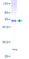 Human SPIC Protein (Recombinant GST)