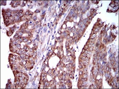STAT5A Antibody (Amino Acid: 583-794, clone 6D4)