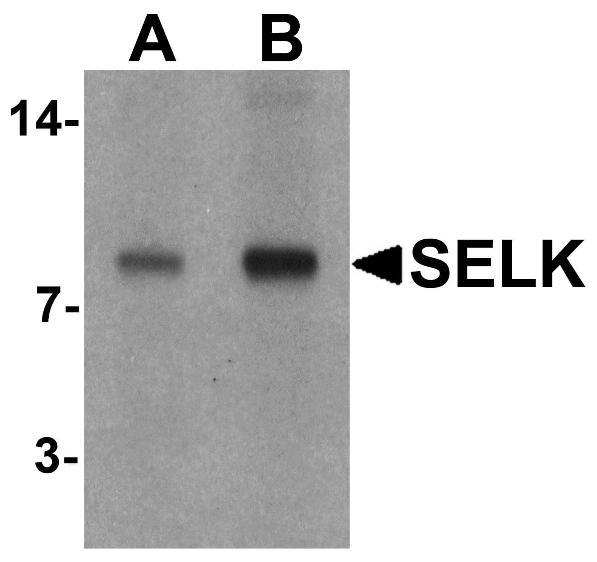 SELK / Selenoprotein K Antibody