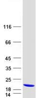 Human ACOT13 / THEM2 Protein (Recombinant Myc-DDK (Flag))