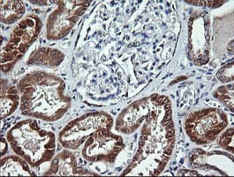 ACAA2 Antibody (clone OTI2H2)
