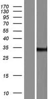 ZNF197 Protein (Over-Expression Lysate Myc-DDK (Flag))
