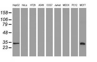 SULT2A1 / Sulfotransferase 2A1 Antibody (clone OTI3G4, Carrier-free)