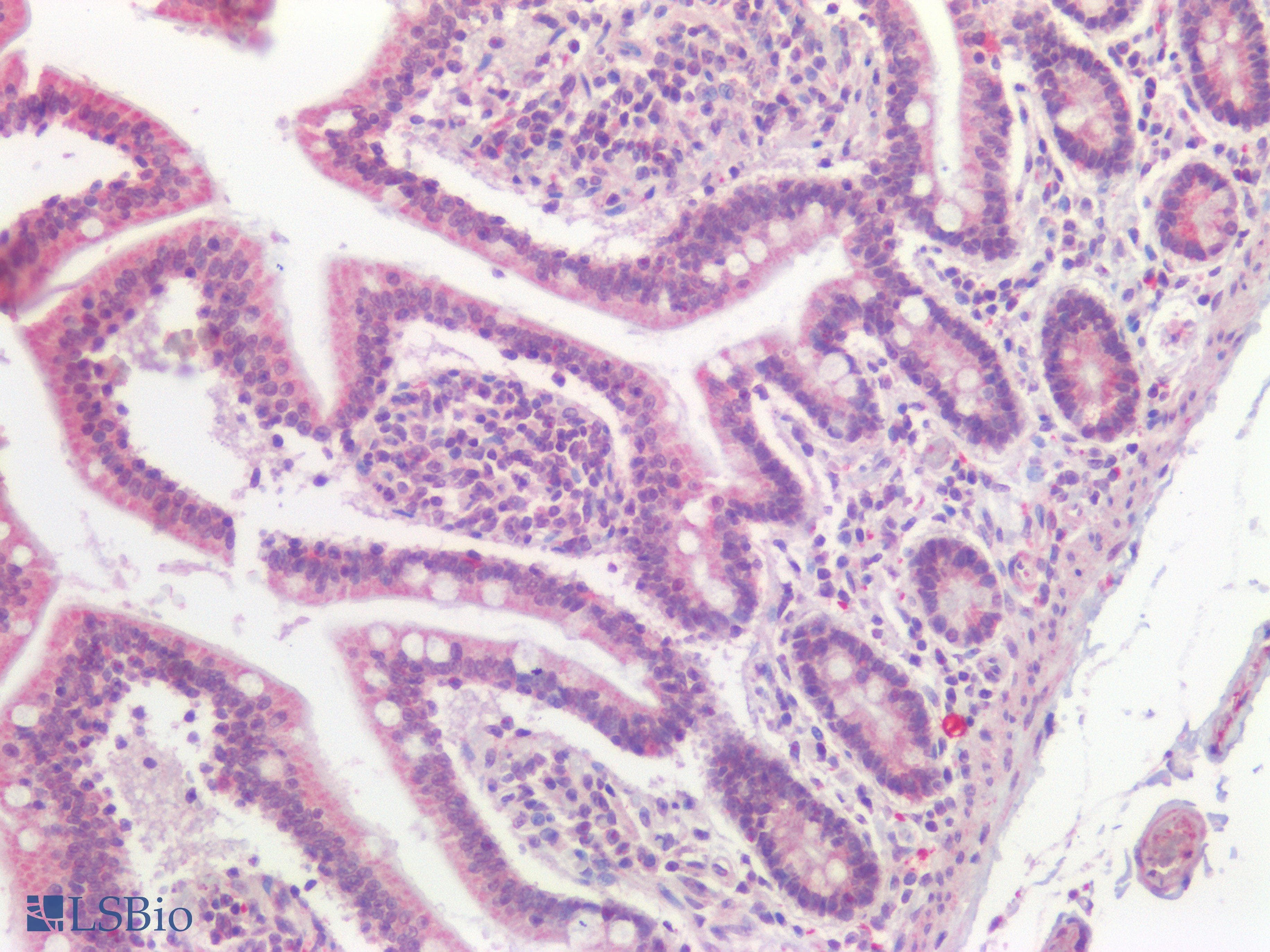 PathPlus™ Polyclonal Rabbit anti-Human Osteocalcin Antibody (IHC)
