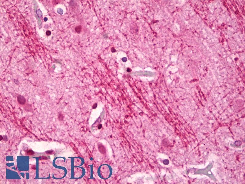 IHC-plus™ Polyclonal Rabbit anti-Human CDK5 Antibody (aa1-50, IHC, WB)