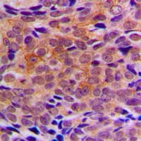 ARFIP1 Antibody (C-Terminus)