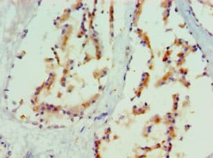 Polyclonal Rabbit anti-Human MAPK13 / p38delta Antibody (aa1-365, IHC)