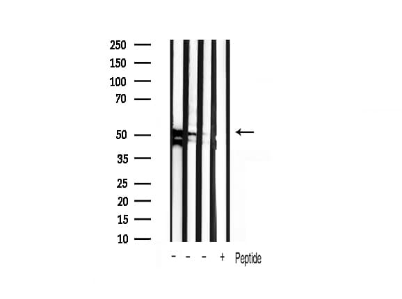 Polyclonal Rabbit anti-Human GSK3A / GSK3 Alpha Antibody (IHC, WB)