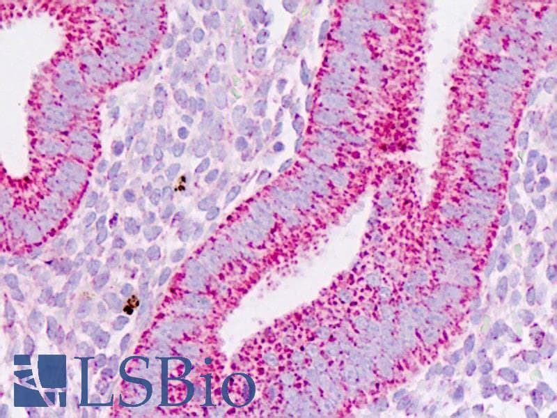 IHC-plus™ Polyclonal Rabbit anti-Human PHB / Prohibitin Antibody (aa182-211, IHC, WB)