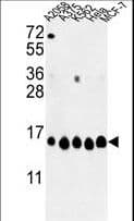 HIST1H2AH Antibody (aa1-30)