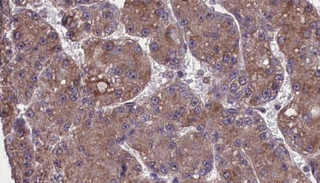 ITGAM / CD11b Antibody