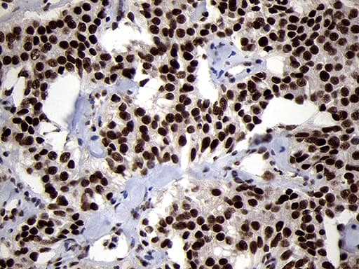 Monoclonal Mouse anti-Human SMC1A / SMC1 Antibody (clone OTI3G4, aa889-1016, IHC, WB)
