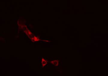 Polyclonal Rabbit anti-Human SNAP25 Antibody (IHC, IF, WB)