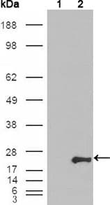 IHC-plus™ Monoclonal Mouse anti-Human GSTP1 / GST Pi Antibody (clone 3F2C2, IHC, IF, WB)