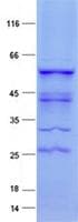 Human GLI2 Protein (Recombinant His, N-Terminal)