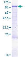 Human CPEB3 Protein (Recombinant GST)