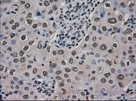 Monoclonal Mouse anti-Human MKI67 / Ki67 Antibody (clone OTI3D11, IHC, WB)