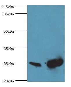 IHC-plus™ SOD2 / Mn SOD Antibody (aa64-175)
