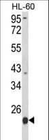 IHC-plus™ Polyclonal Rabbit anti-Human PSMB9 Antibody (aa193-219, IHC, WB)